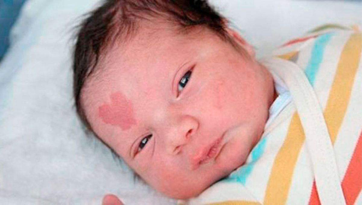 Muchos bebés llegan al mundo con manchas en la piel de diversos tamaños y colores. Muchos bebés llegan al mundo con manchas en la piel de diversos tamaños y colores.