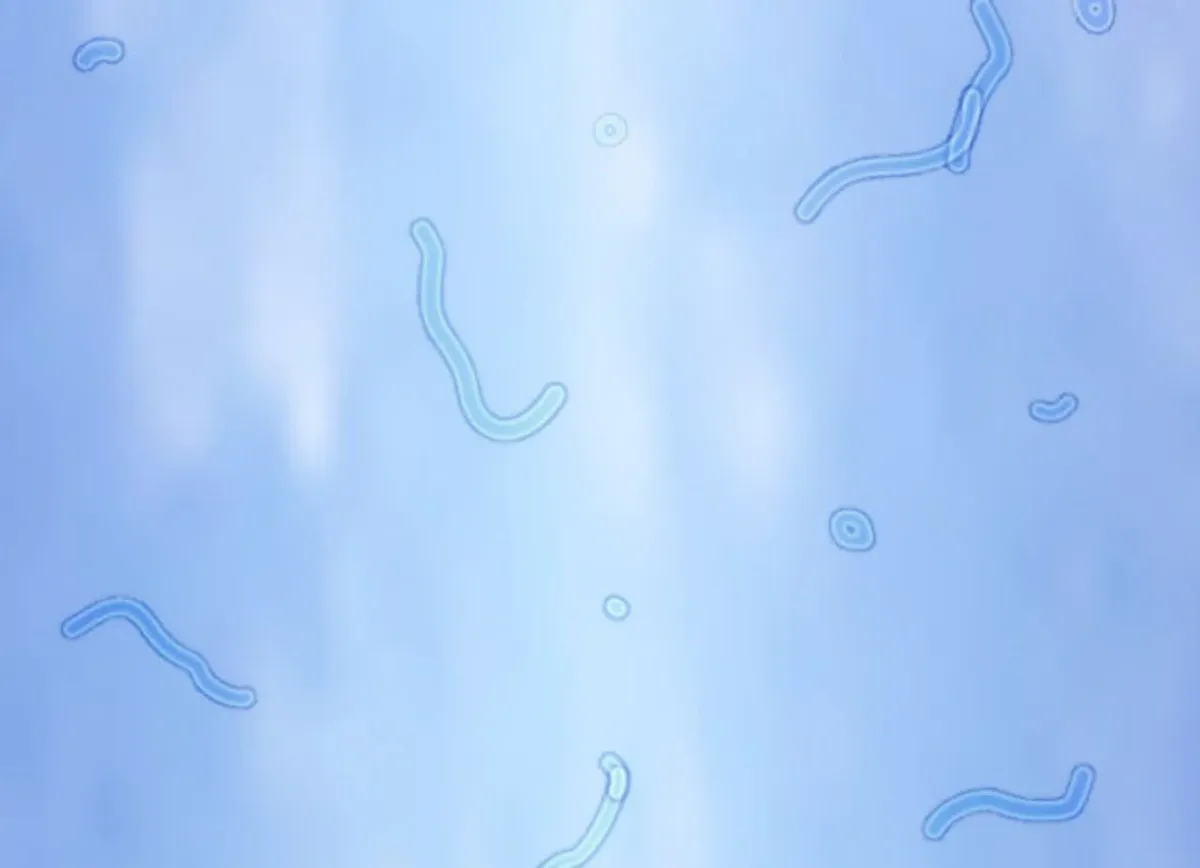 Los flotadores son muy molestos para algunas personas. Los flotadores son muy molestos para algunas personas.