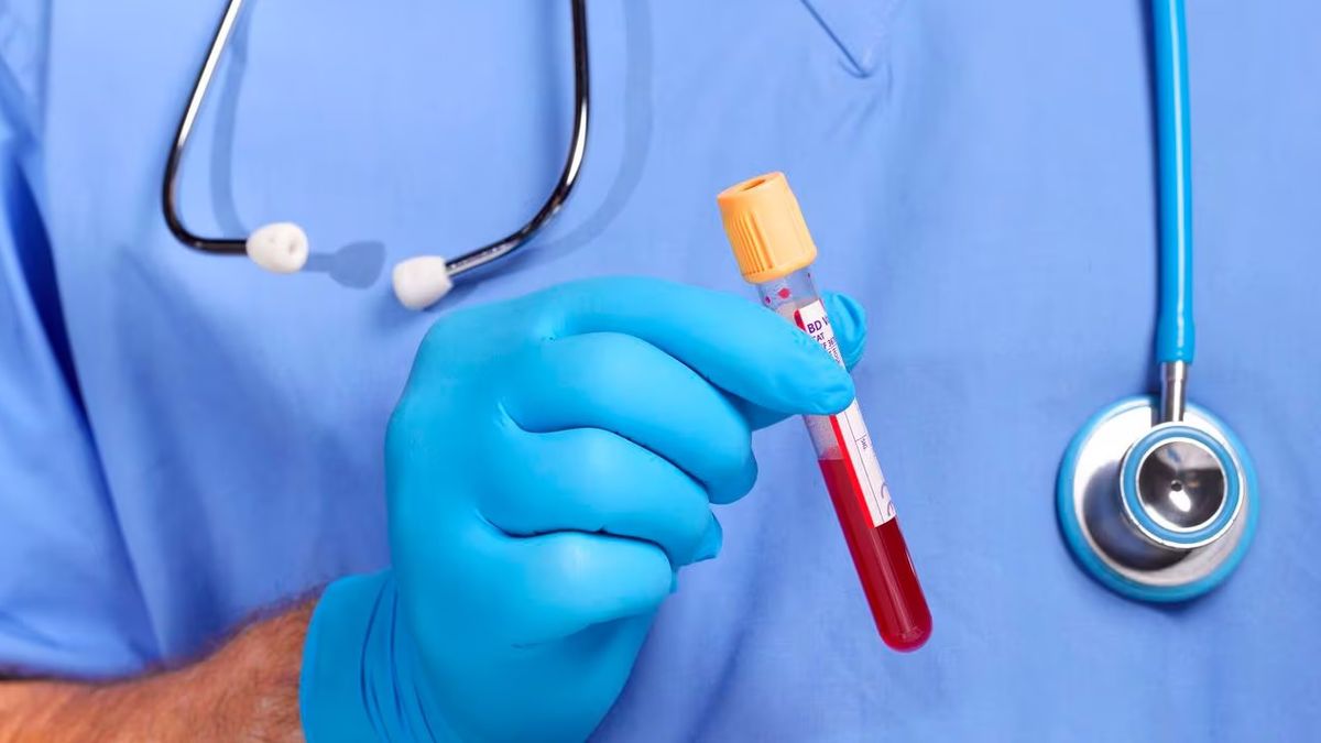 Mielofibrosis, una enfermedad rara y poco frecuente que afecta la médula ósea