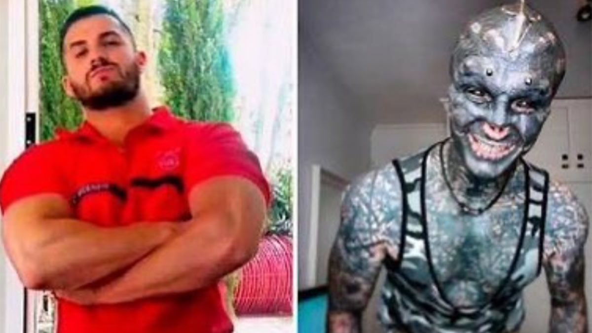 Anthony ya se operó la nariz, se sacó las dos orejas y ahora se cortó cuatro dedos de la mano para parecerse a un alien.