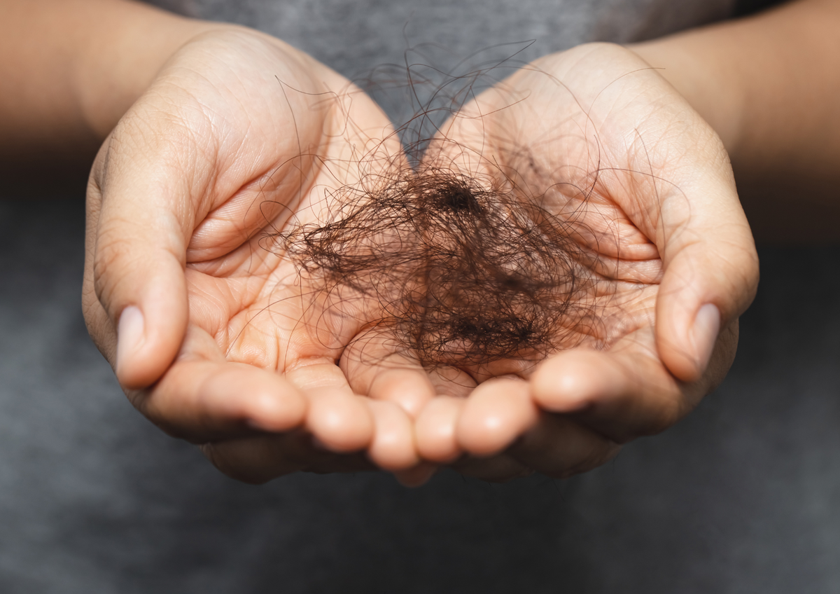 Evita la caída del cabello gracias a los nutrientes de estas vitaminas. Evita la caída del cabello gracias a los nutrientes de estas vitaminas.