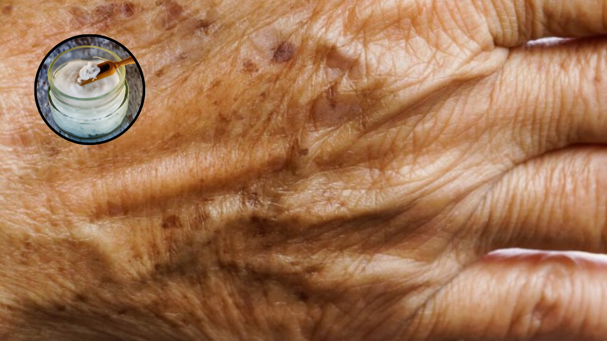 Las manchas en las manos pueden aparecer en las manos por diversas razones, este truco casero te ayudará a eliminarlas fácilmente. Las manchas en las manos pueden aparecer en las manos por diversas razones, este truco casero te ayudará a eliminarlas fácilmente.