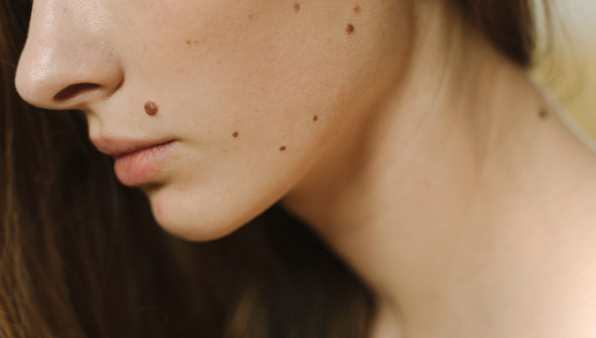 Lunar labio. Lunar labio. 