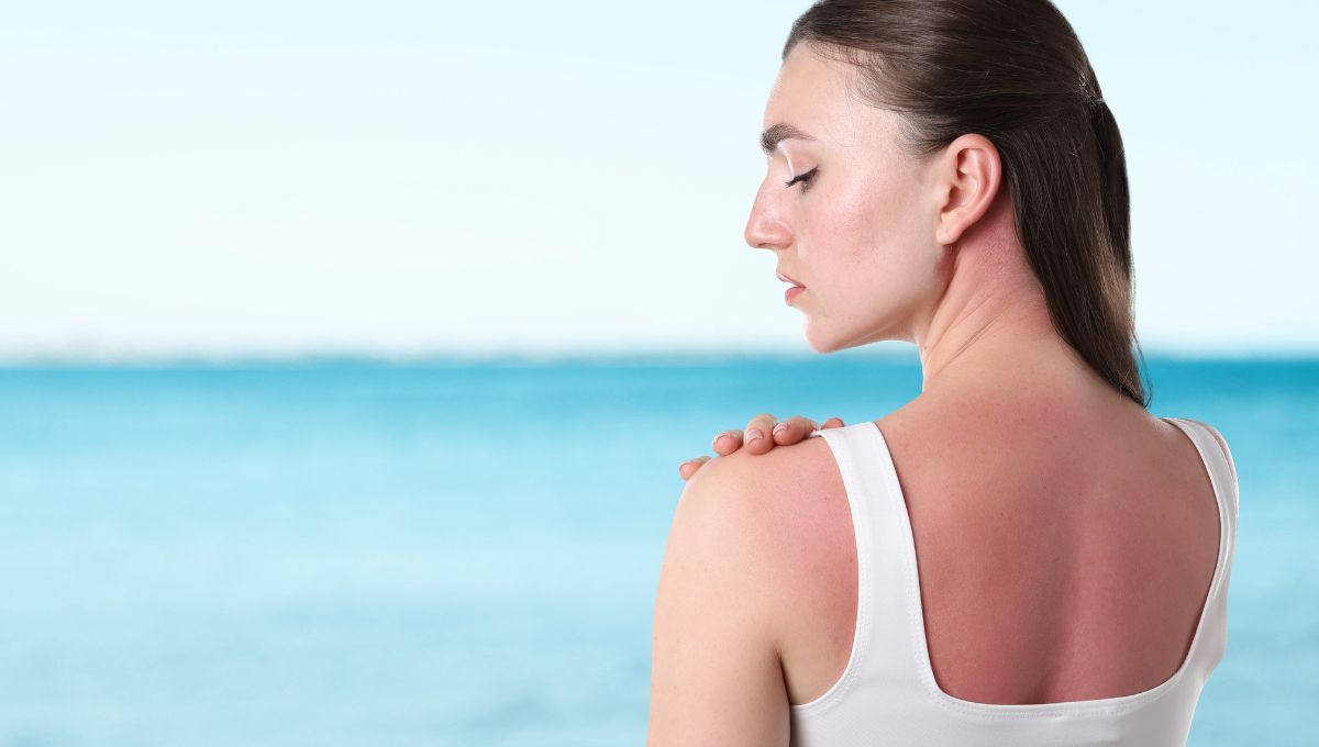 Cuando no nos aplicamos protector solar, terminamos con la piel quemada.&nbsp;