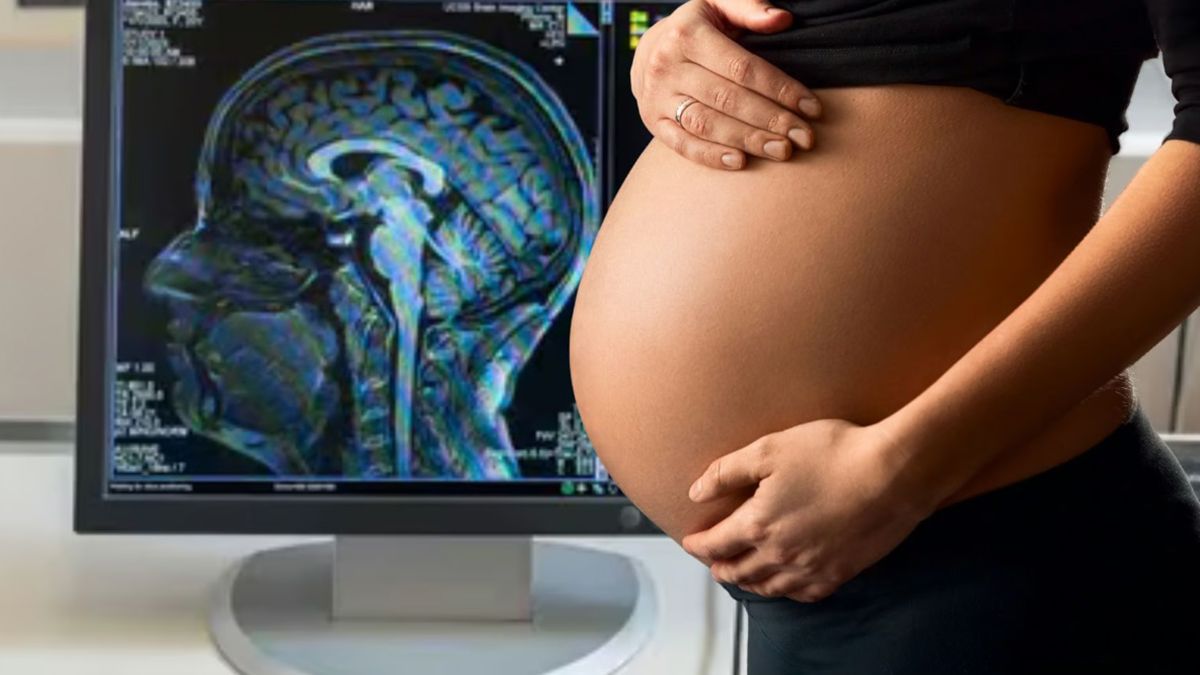 Una investigación científica muestra cómo se reestructura el cerebro de la mujer durante la gestación Una investigación científica muestra cómo se reestructura el cerebro de la mujer durante la gestación