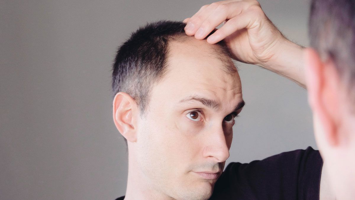 Primero lo primero: Conocer el por qué de la caída capilar, para encontrar soluciones que funcionen 