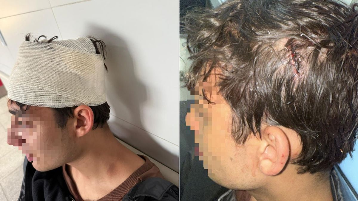 Tras la golpiza de los rugbiers, Agustín sufrió cortes en la cabeza, en el labio y le reventaron el tímpano. Tras la golpiza de los rugbiers, Agustín sufrió cortes en la cabeza, en el labio y le reventaron el tímpano.