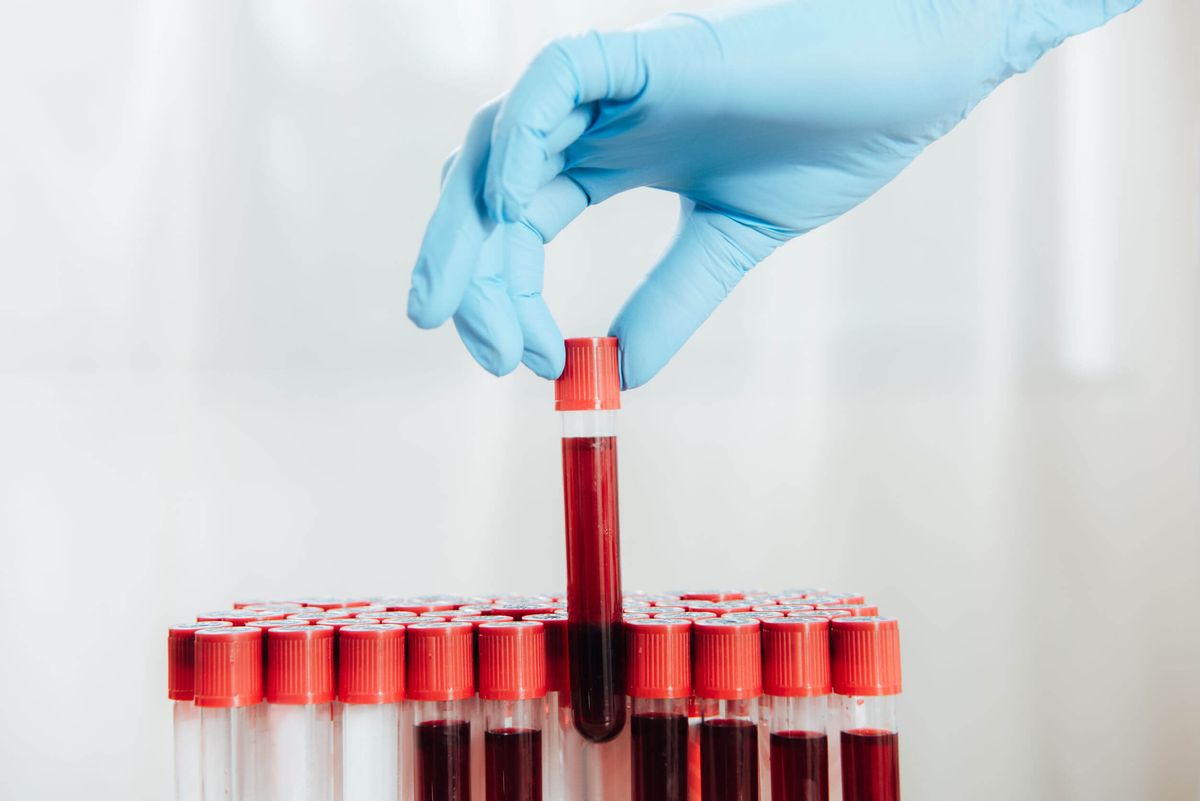 El virus de la inmunodeficiencia humana (VIH) mantiene su condición de uno de los problemas de salud pública más extendidos del planeta El virus de la inmunodeficiencia humana (VIH) mantiene su condición de uno de los problemas de salud pública más extendidos del planeta