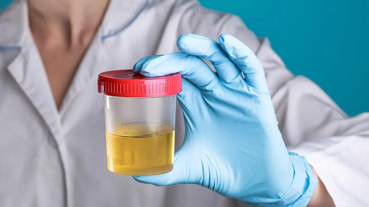 La orina puede ser el indicador de salud de una persona. La orina puede ser el indicador de salud de una persona. 