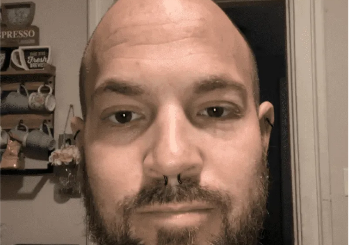 ¿Qué tenía? Creyó que tenía coronavirus, pero le hallaron algo increíble en los pulmones.