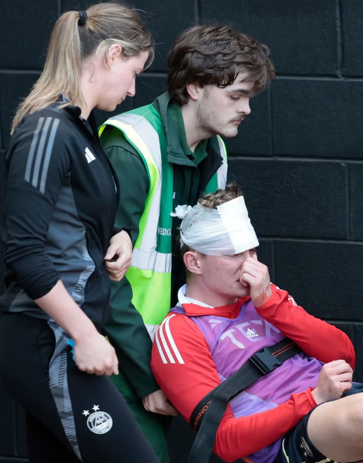 El jugador qued&oacute; desfigurado permanentemente tras un nuevo hecho de violencia en el f&uacute;tbol.