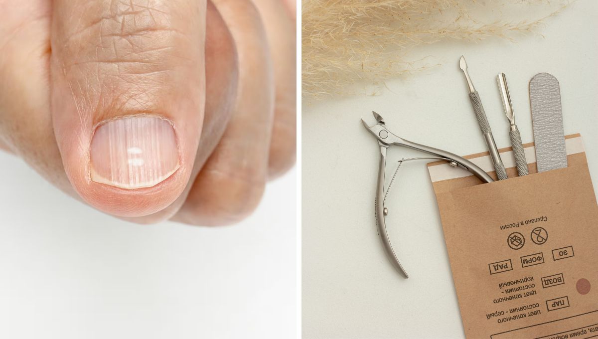 Descubre por qué aparecen las rayas en las uñas y cómo corregirlas