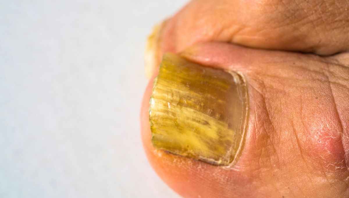 Coloca las uñas en agua con vinagre o remójalas con unos algodones. Coloca las uñas en agua con vinagre o remójalas con unos algodones. 