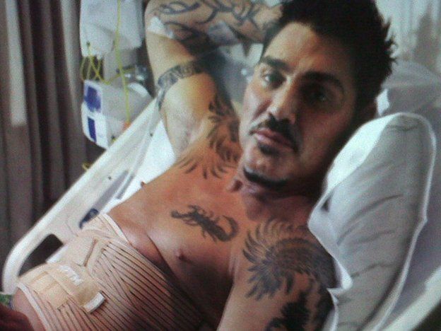 La policía secuestró la historia clínica de Ricardo Fort por dudas sobre las causas de su muerte