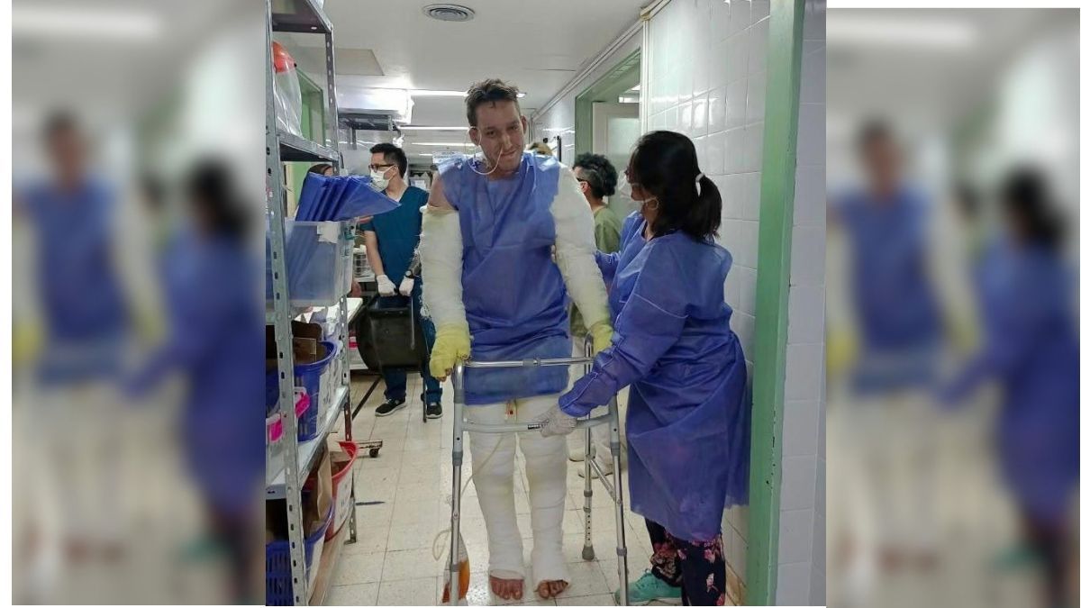 Después de un mes en terapia intensiva, comenzó su recuperación. Después de un mes en terapia intensiva, comenzó su recuperación.