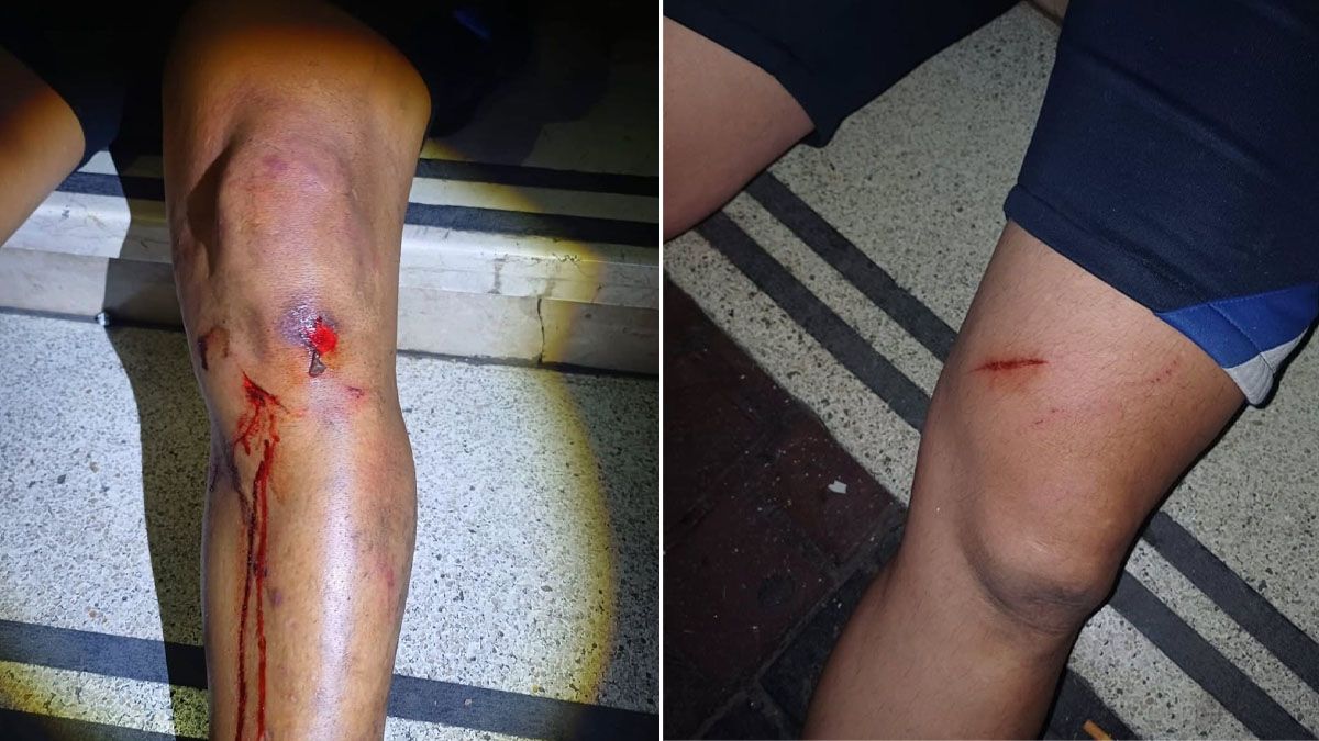 Varios policías terminaron heridos en medio de la manifestación en pleno centro. Varios policías terminaron heridos en medio de la manifestación en pleno centro.