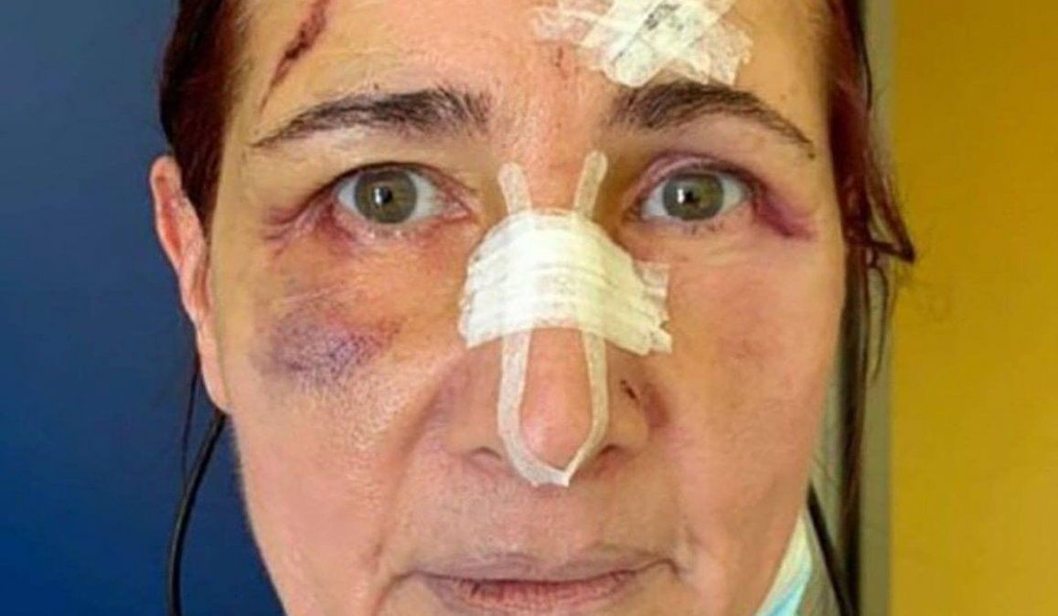 Coronavirus: recibió una paliza por pedir a una persona que se ponga el barbijo