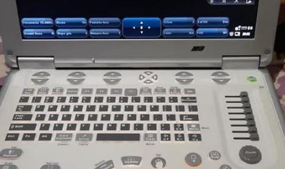 El equipamiento vale unos 12.000 dólares y era ofrecido a $8,5 millones.