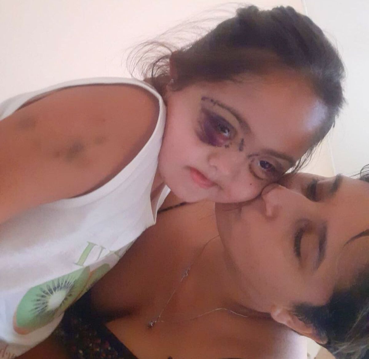 Poco después del alta, que para la familia fue milagrosa. Poco después del alta, que para la familia fue milagrosa.