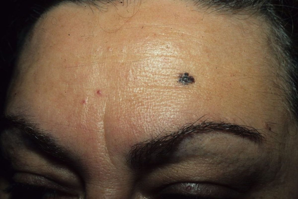 Así, si tienes un lunar aquí, podría ser que la vida te lleve a situaciones donde tu carácter y voluntad serán puestos a prueba. Así, si tienes un lunar aquí, podría ser que la vida te lleve a situaciones donde tu carácter y voluntad serán puestos a prueba.