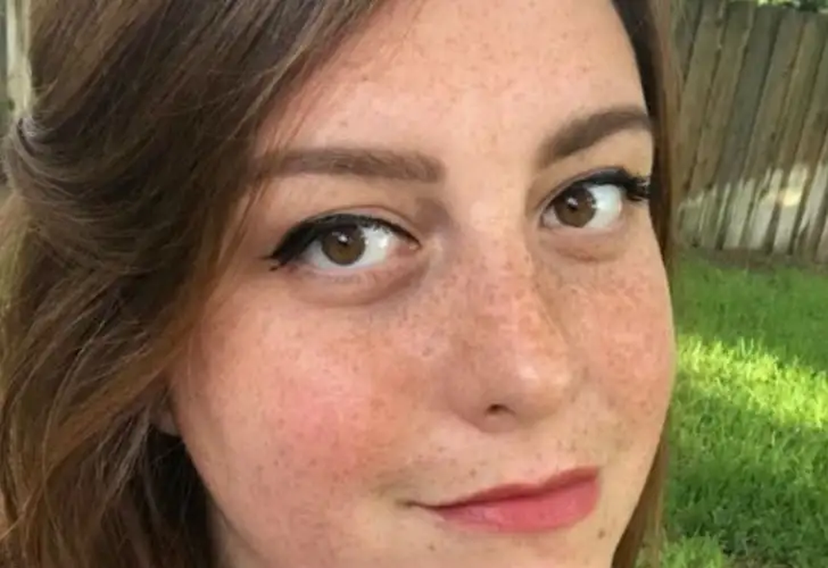 Katie Holley, la joven que tuvo a una cucaracha dentro de su cabeza.&nbsp;