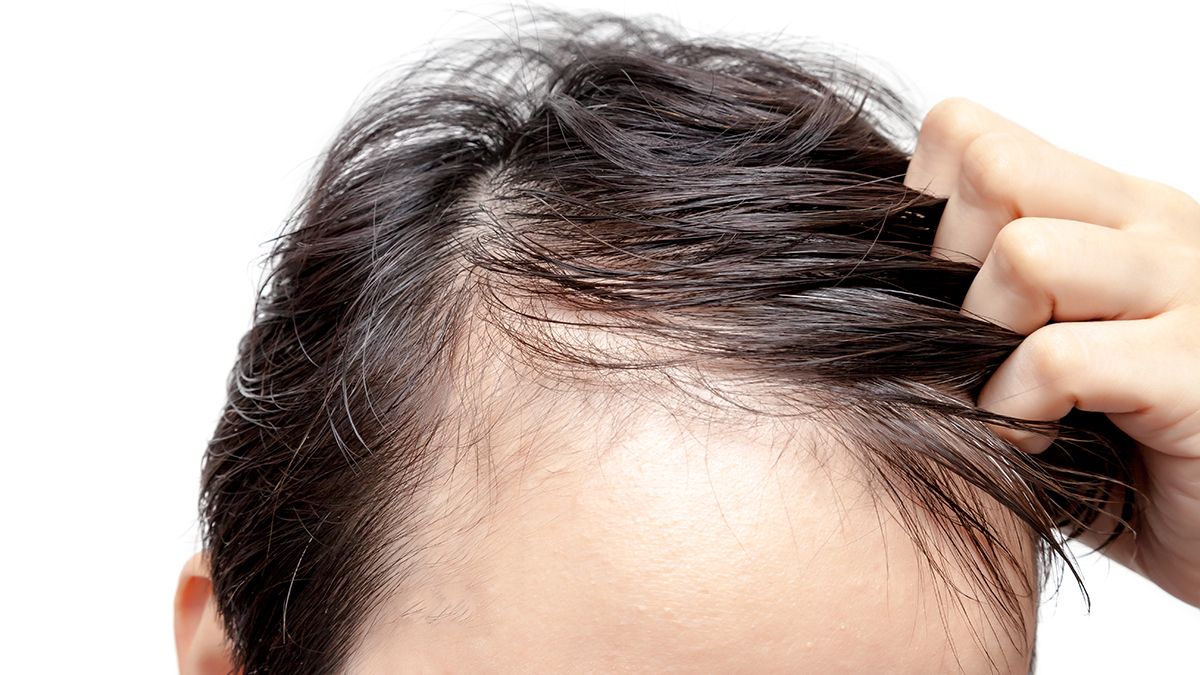 Los fundadores de Hair Recovery realizaron una revolución en el mundo de la recuperación capilar.