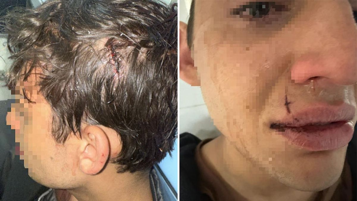 Un joven de 18 años fue golpeado por un grupo de rugbiers: 