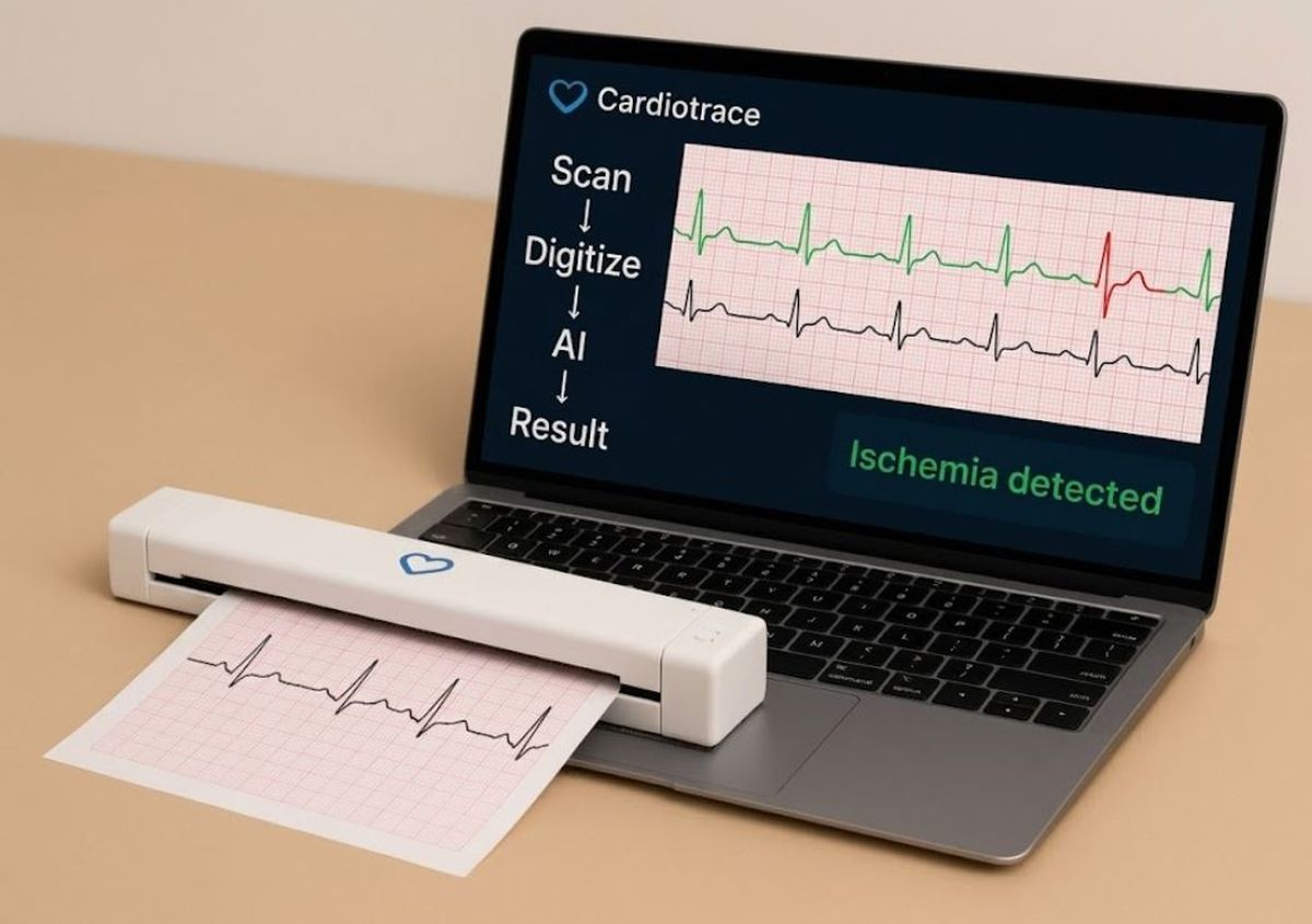 Cardiotrace, el escáner con IA que ayuda a prevenir infartos. Foto: UNSAM&nbsp;