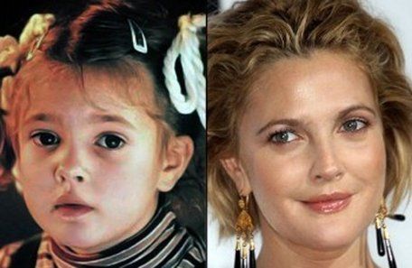El antes y el después de los famosos