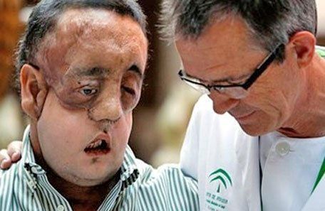 El noveno trasplantado de cara del mundo agradeció a la familia del donante