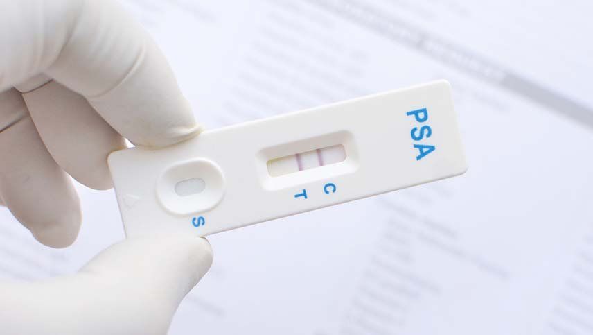 Crearon un test de cáncer de próstata parecido a la prueba de embarazo