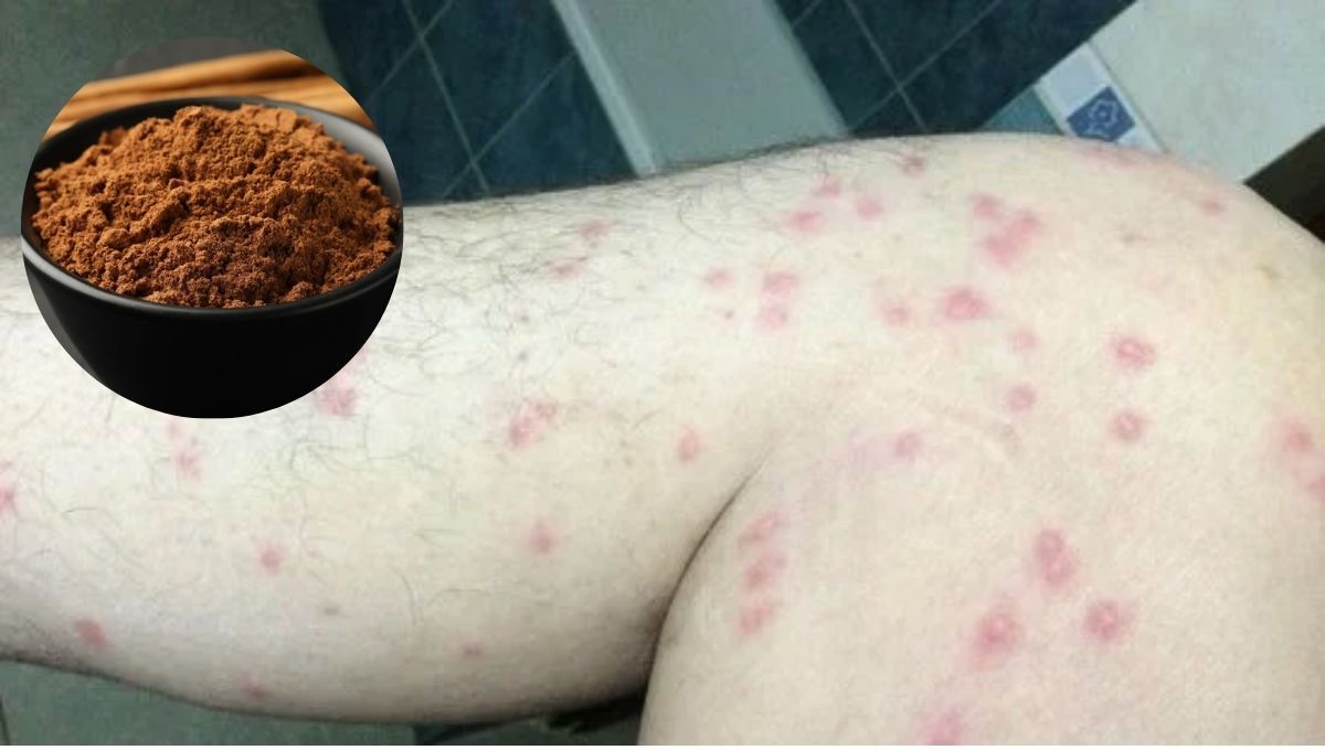 Cómo evitar la mordida de los jejenes usando un poco de canela: repelente casero efectivo