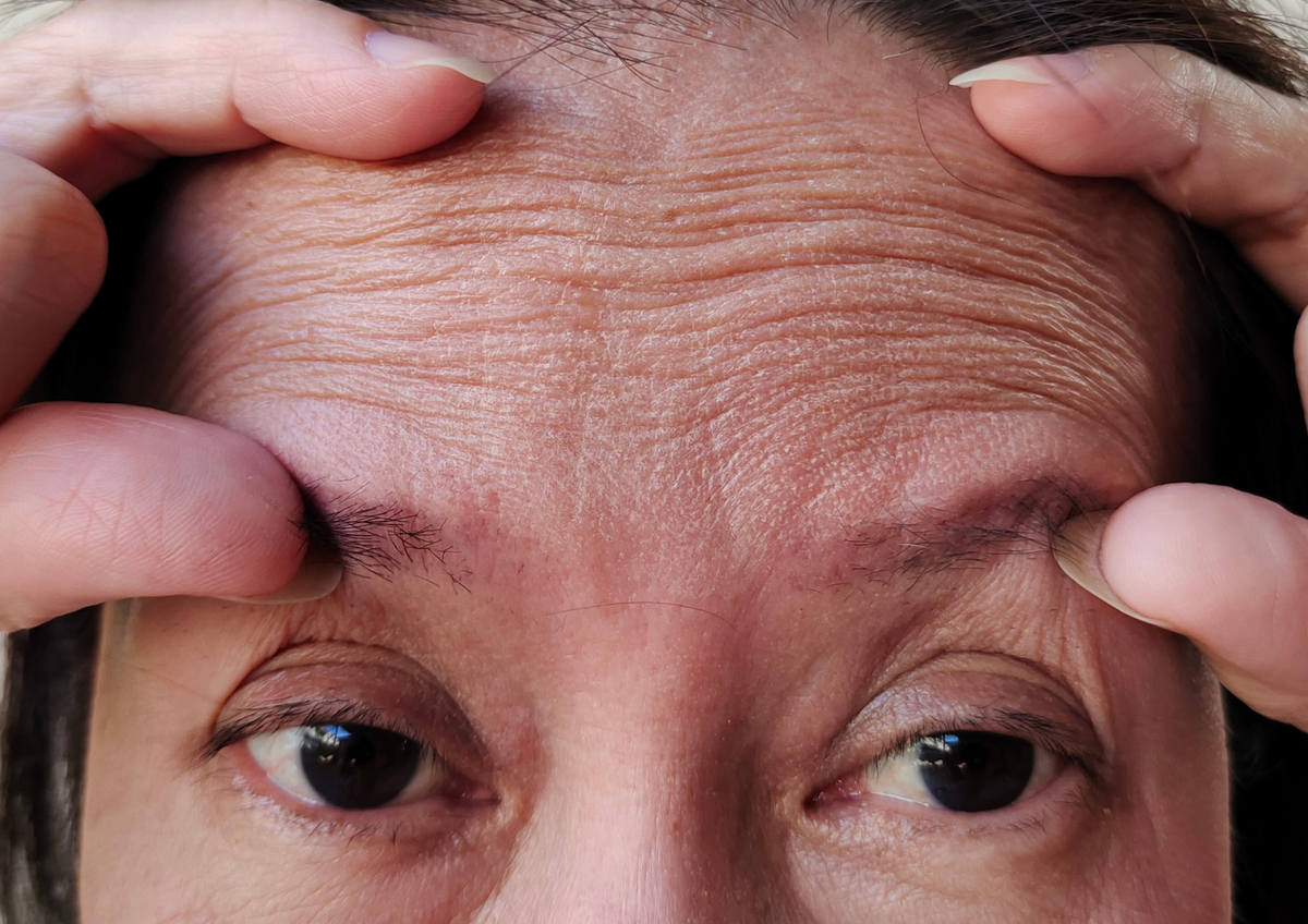 Alternativas para el cuidado de la piel y reducción de las arrugas&nbsp;