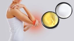 Dile adiós al dolor de rodilla, espalda y codos gracias a esta pomada casera
