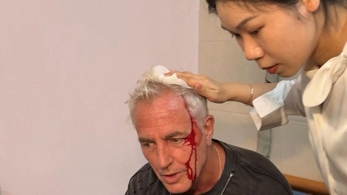 "No fue nada", dijo Marley sobre un accidente con una estalactita. "No fue nada", dijo Marley sobre un accidente con una estalactita.