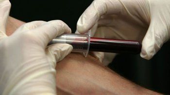 Desarrollan un dispositivo que extrae sangre sin agujas ni dolor