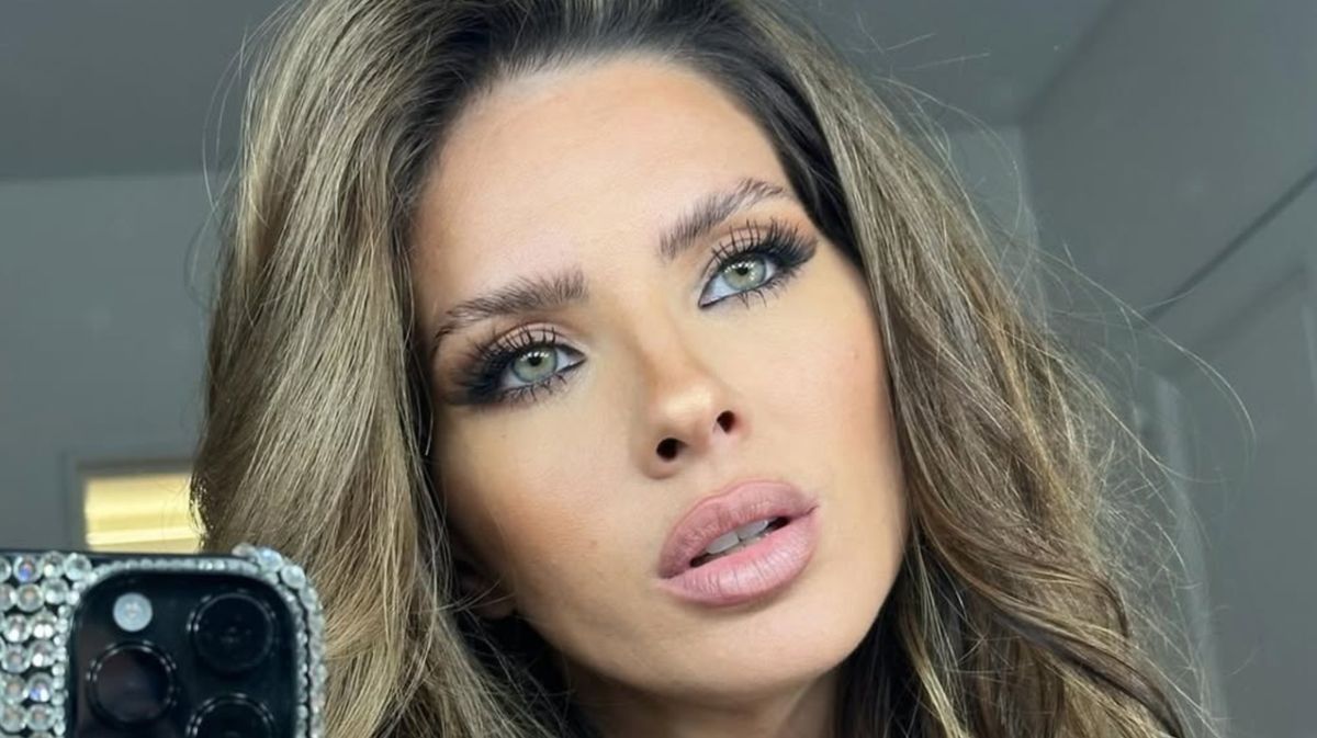 ¿Qué se hizo la China Suárez en la cara?