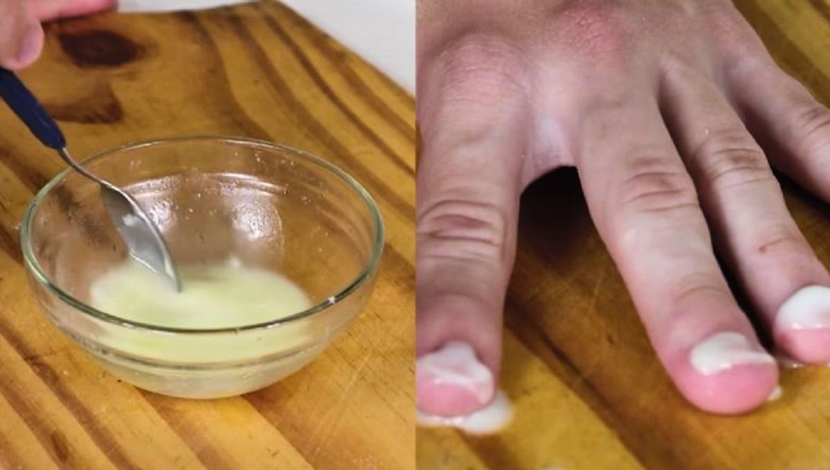 El bicarbonato es ideal para eliminar hongos de las uñas. Fuente Gastrolab El bicarbonato es ideal para eliminar hongos de las uñas. Fuente Gastrolab