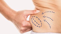 Cómo desaparecer la panza por estrés, un mal que aqueja a los millennials