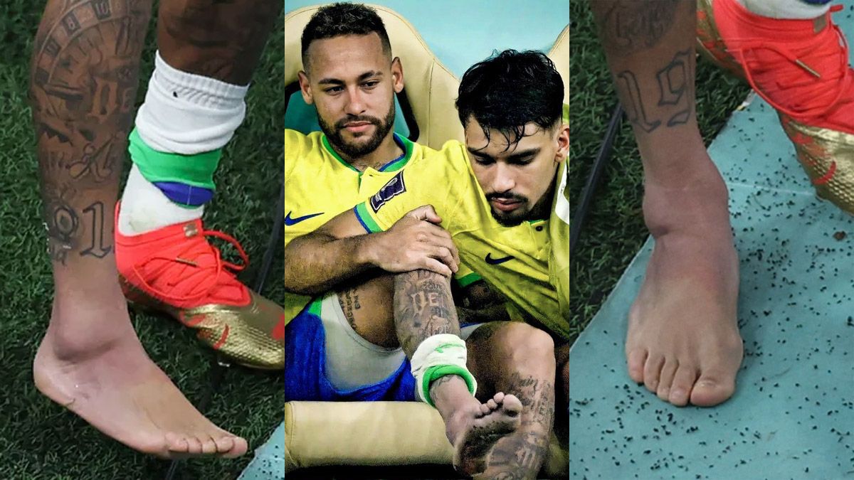 Neymar no jugará los próximos dos partidos de Brasil de la fase de grupos del Mundial Qatar 2022.