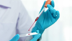 Argentina: Descubrieron seis casos de un rarísimo grupo sanguíneo. Argentina: Descubrieron seis casos de un rarísimo grupo sanguíneo.