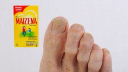 Remedio casero para eliminar los hongos de los pies usando maicena