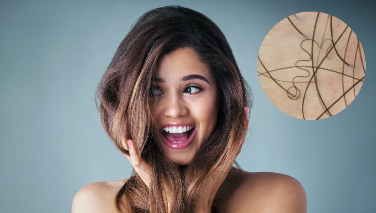 Pili Torti, la enfermedad capilar que cada vez aqueja a más personas