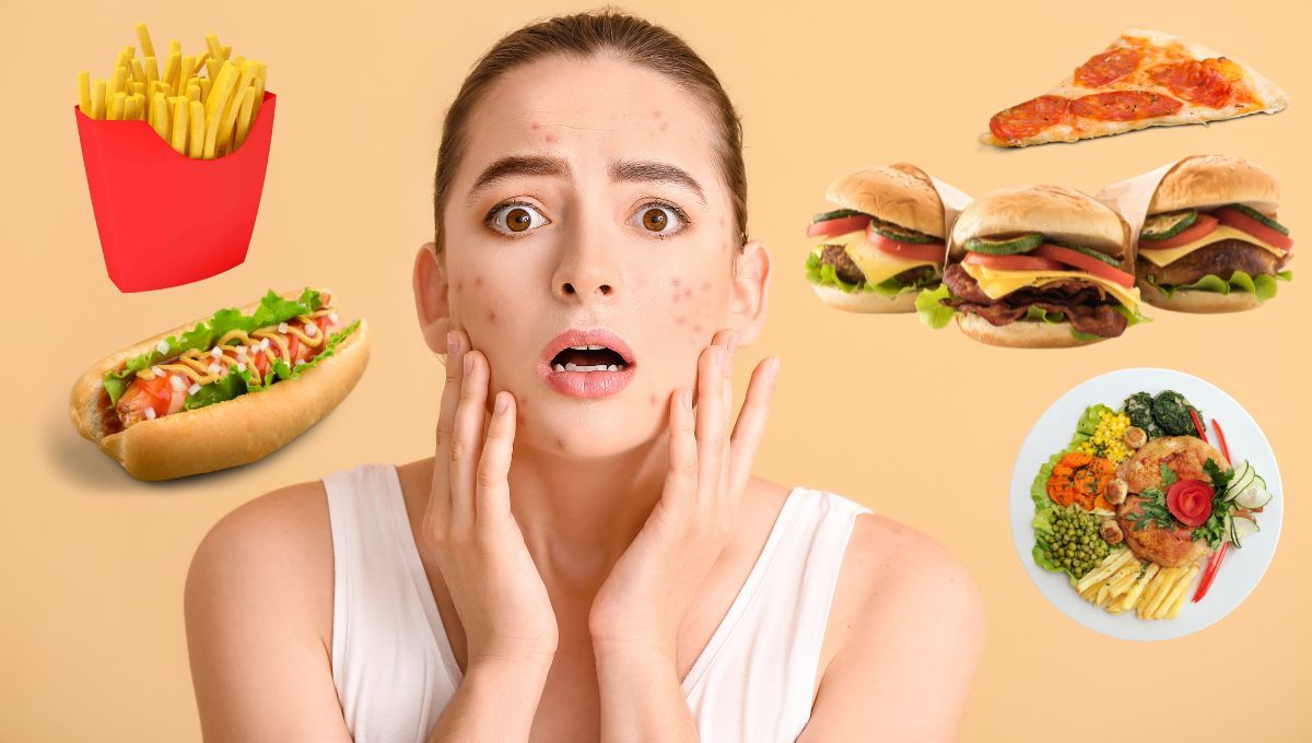 Los alimentos que tenés que evitar porque favorecen la aparición de granitos y puntos negros