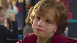 ¿En qué películas han aparecido personajes con el Síndrome de Treacher Collins?