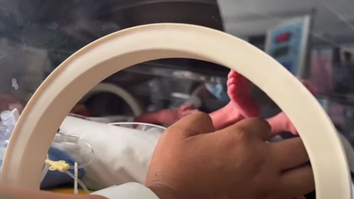 Una mujer dio a luz a trigemelas genéticamente idénticas en un hospital recién inaugurado, y se trata de un caso cada millones