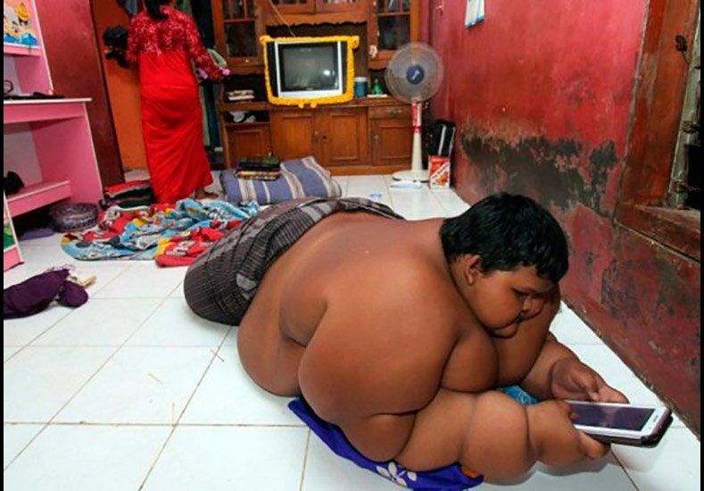 Temen por la vida del niño más obeso del mundo: pesa 192 kilos a los 10 años