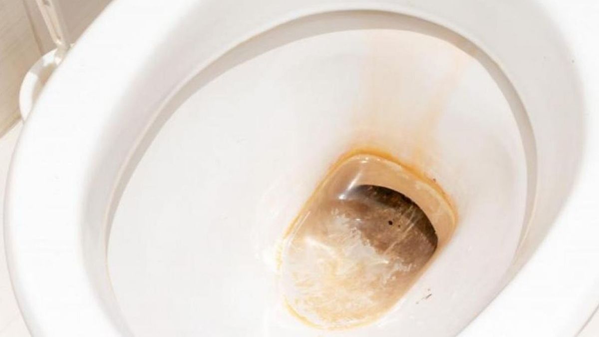 El medicamento de alto consumo que es ideal para eliminar el sarro de tu inodoro El medicamento de alto consumo que es ideal para eliminar el sarro de tu inodoro