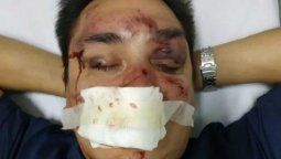 Fuertes imágenes: brutal golpiza a un periodista partidario