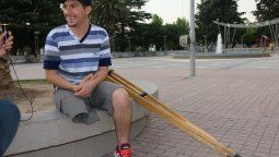 Le amputaron una pierna
